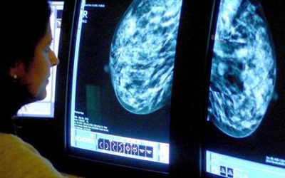 Antibody discovery offers breakthrough in breast cancer fight