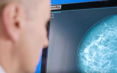 Artificial intelligence set to assist breast screening in Ireland