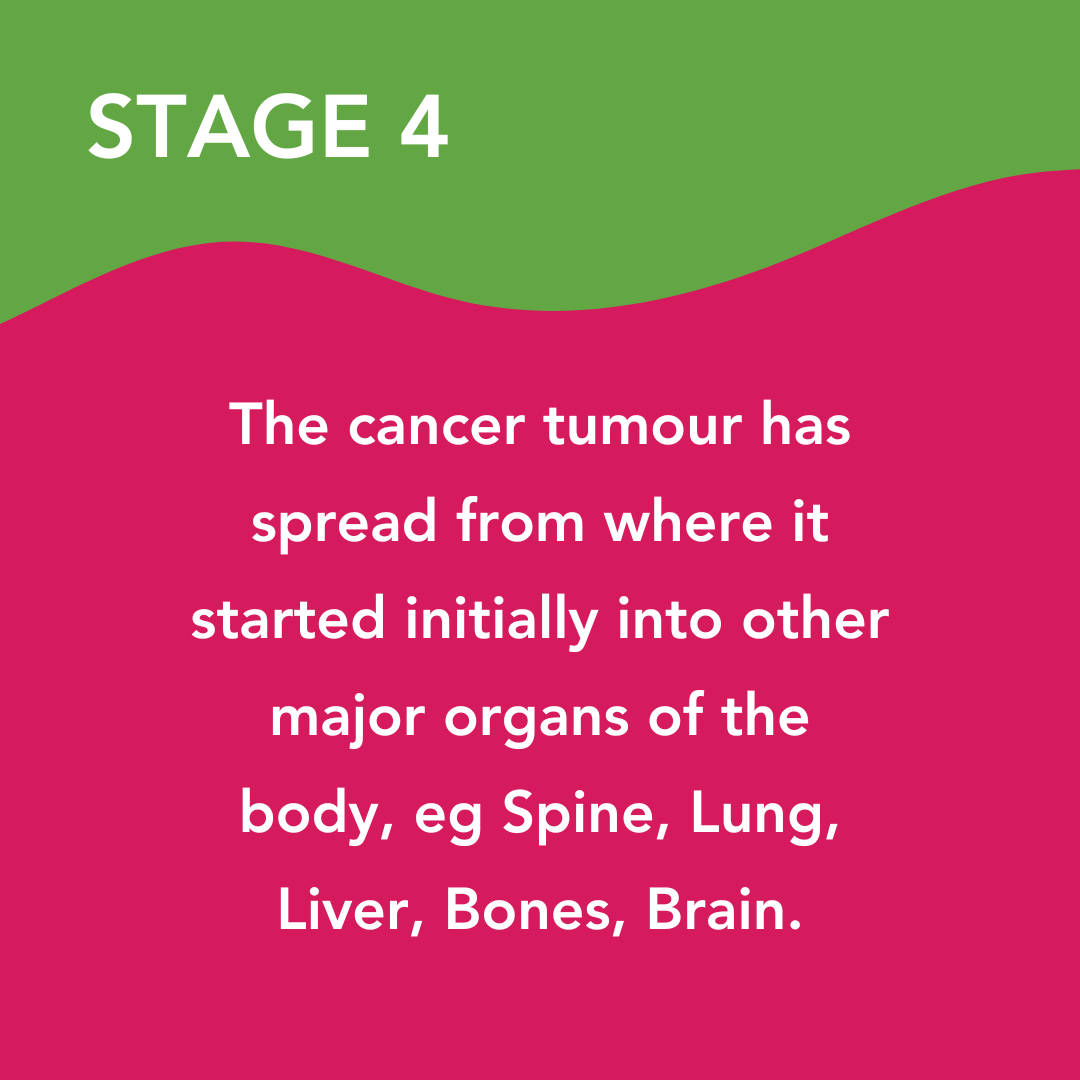 The stages of cancer diagnosis, stage 2